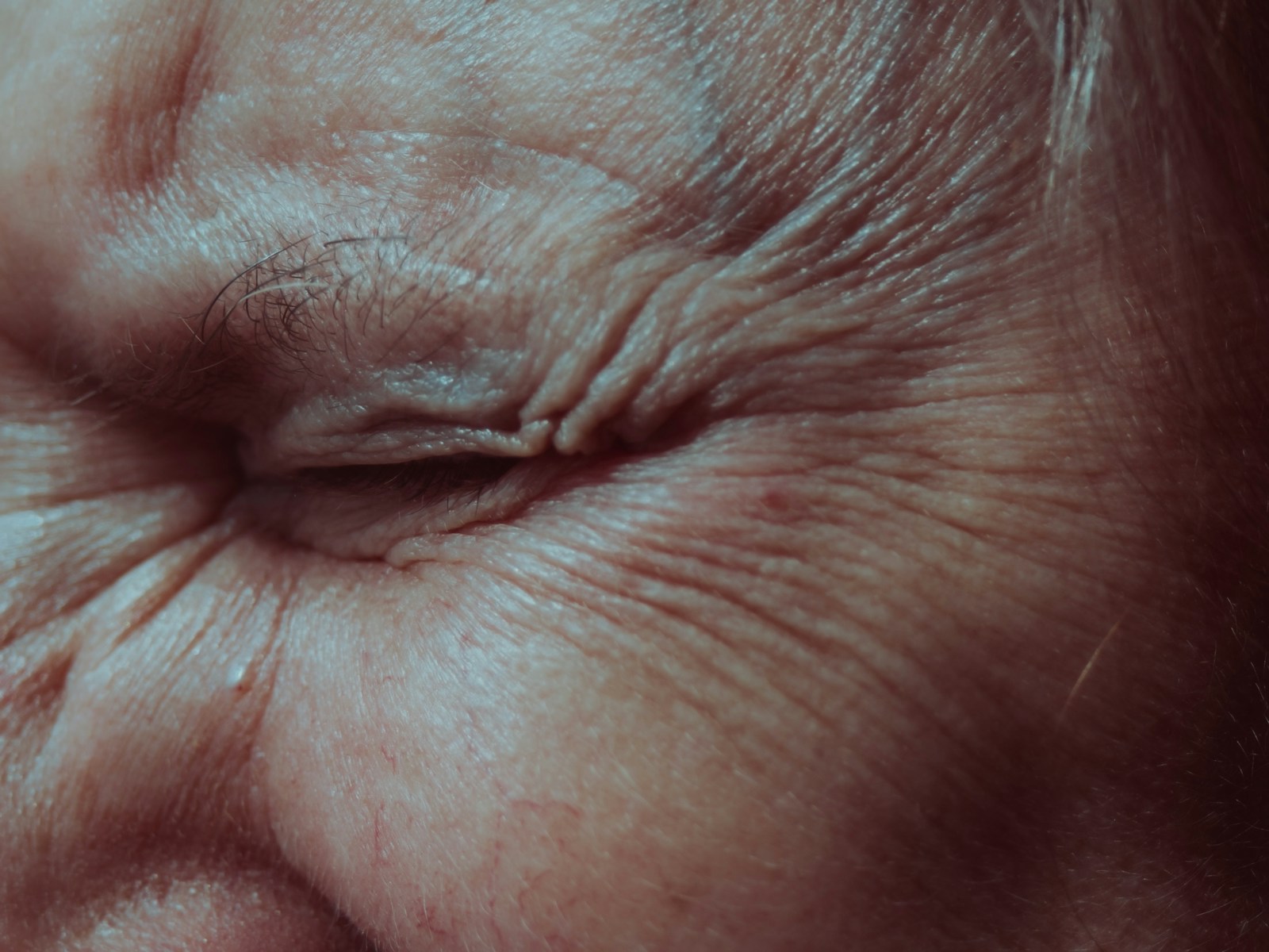 Your Simple Guide to Anti-Wrinkle Treatments in Truro